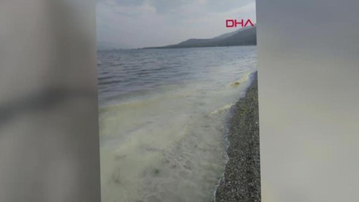 İSTANBUL-PROF. DR. MUSTAFA SARI ŞU AN KREMSİ MÜSİLAJI GÖRÜYORUZ