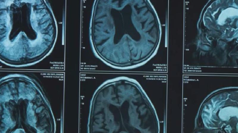 Yaşın ilerlemesi siyaset yapmaya engel mi?