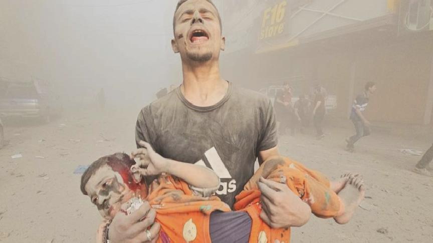 Gazze Şeridi’nden 1000 Filistinli çocuk BAE’de tedavi edilecek