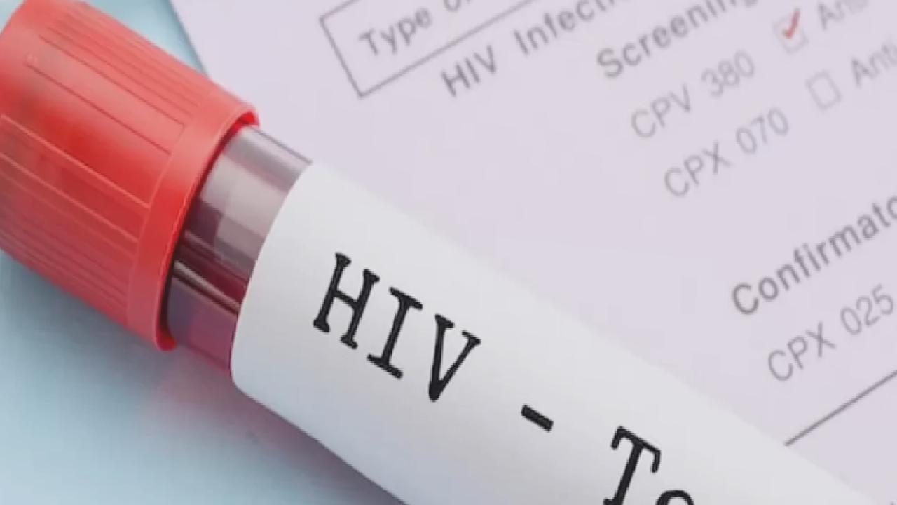 “Türkiye’de HIV pozitif kişi sayısı, son 10 yılda 4 kat arttı”