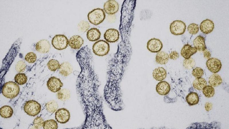 Açıklanamayan salgın hastalıklar ne kadar yaygın?