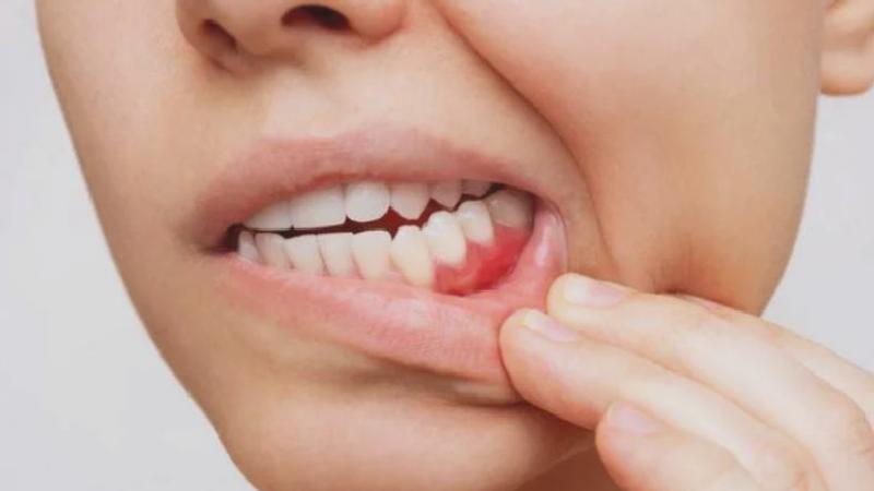 Ağız sağlığımız, vücudumuz hakkında bize ne anlatıyor?