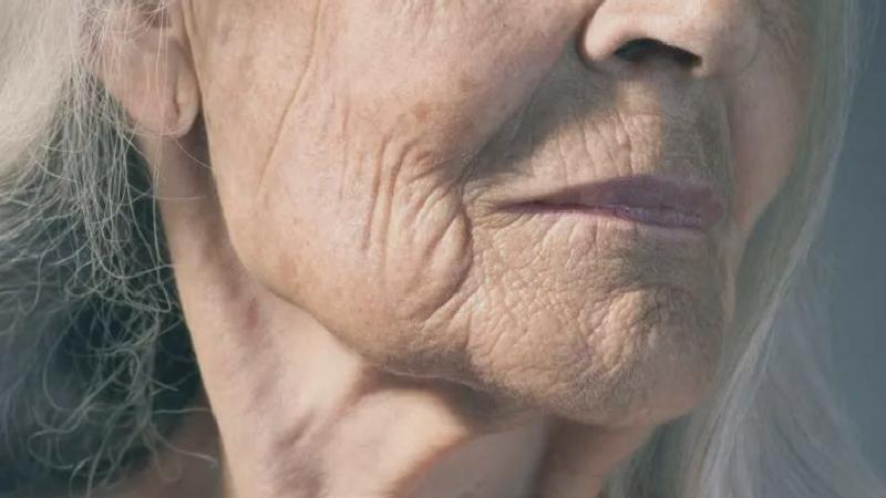 Hücre Atlası: Cildin yaşlanmasını geciktirebilecek yeni bir yöntem keşfedildi