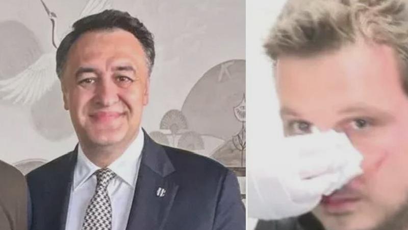 Gazeteci yumruklayan Sezgin Gülnar’a 120 gün hak mahrumiyeti cezası