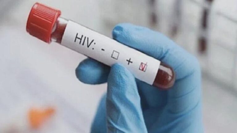 “HIV vakalarında artış var”: İşte 4 soruda en çok merak edilenler