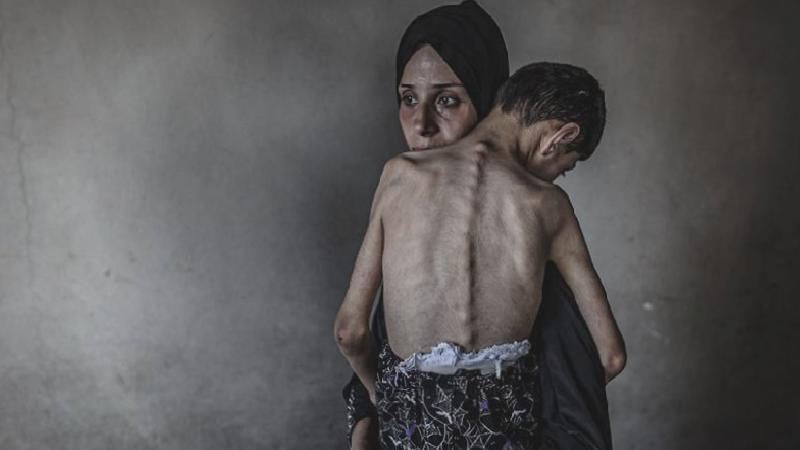 Gazze Şeridi’nde son 24 saatte 5 Filistinli daha açlıktan hayatını kaybetti