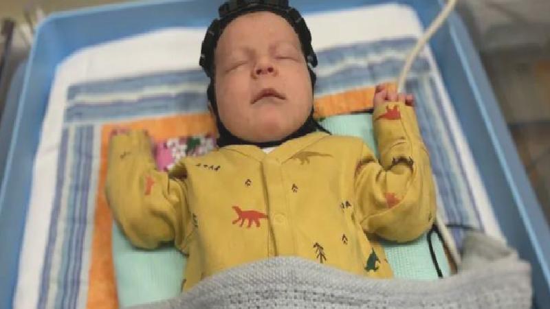 İngiltere’de bilim insanları doğumda beyin hasarını tespit edebilecek başlık geliştirdi