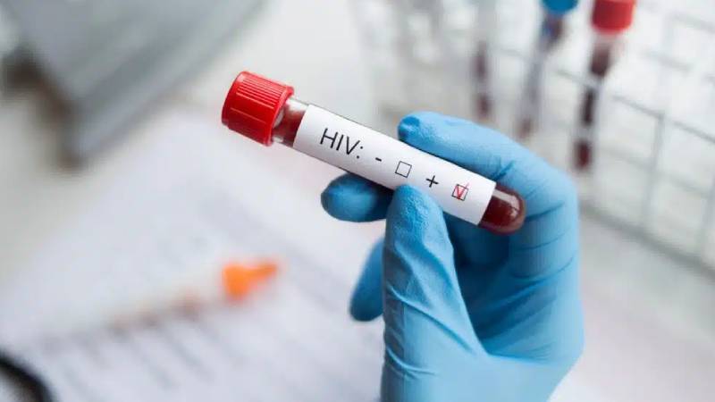 Türkiye HIV’de ‘sessiz pandemi’ yaşıyor; vakaların yarısı teşhis bile alamıyor!