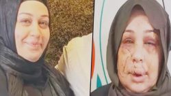 Boşanmak isteyen eşinin tırnak makasıyla yüzünü kesen Cumhurbaşkanı Koruma Dairesi personeline iyi hal indirimi; sadece 4 yıl 2 ay ceza aldı!